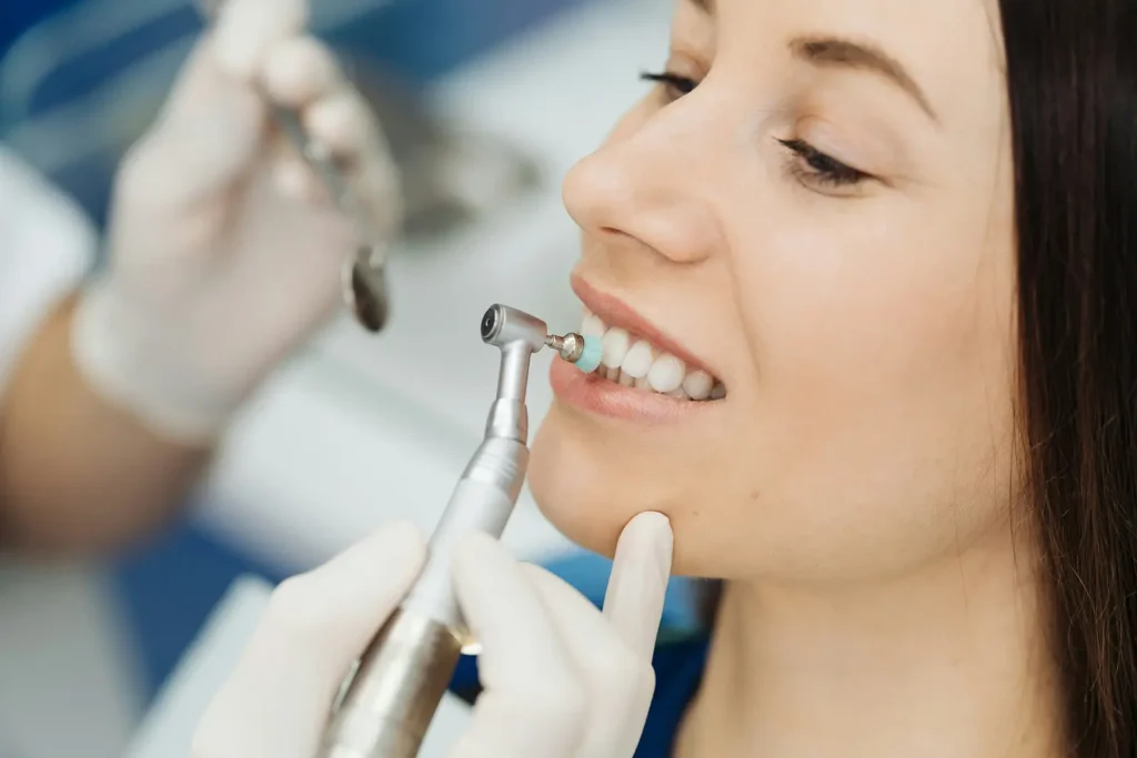 Sunde hvide tænder efter professionel tandrensning