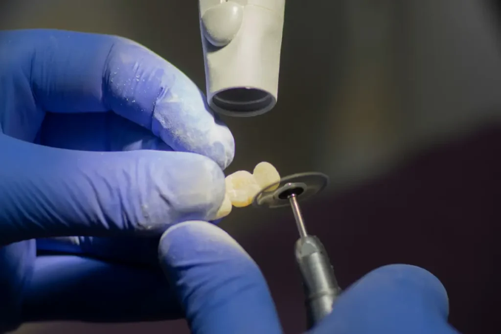 Moderne teknologi brugt til tandbehandlinger