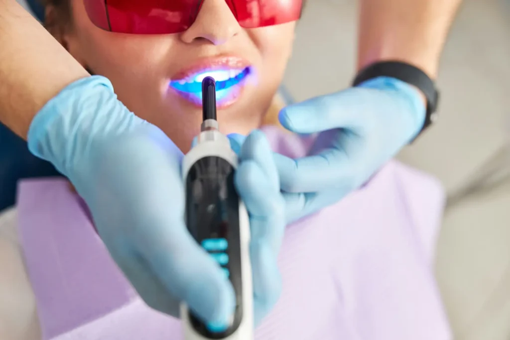 Tandlæge udfører professionel tandblegning